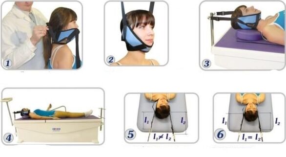 Trattamento dell'osteocondosi cervicale con eliminazione