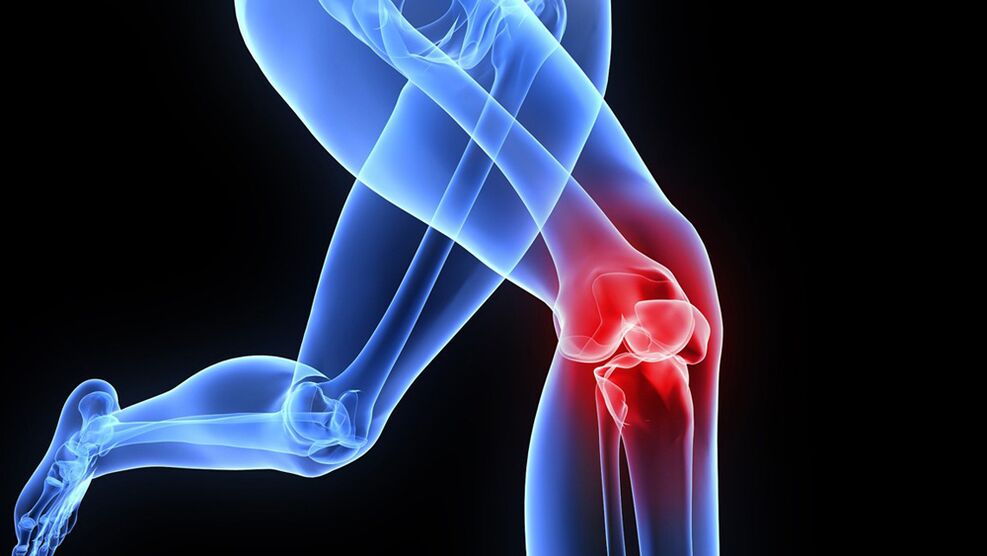 problemi alle ginocchia dovuti all'artrosi